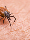 Lyme Disease