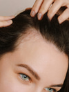 A Breakthrough in Treating Hair Loss from Alopecia Areata