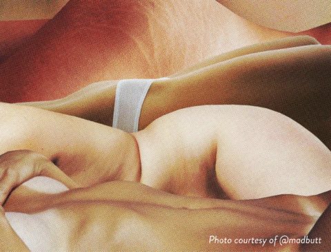 Pelvic Organ Prolapse