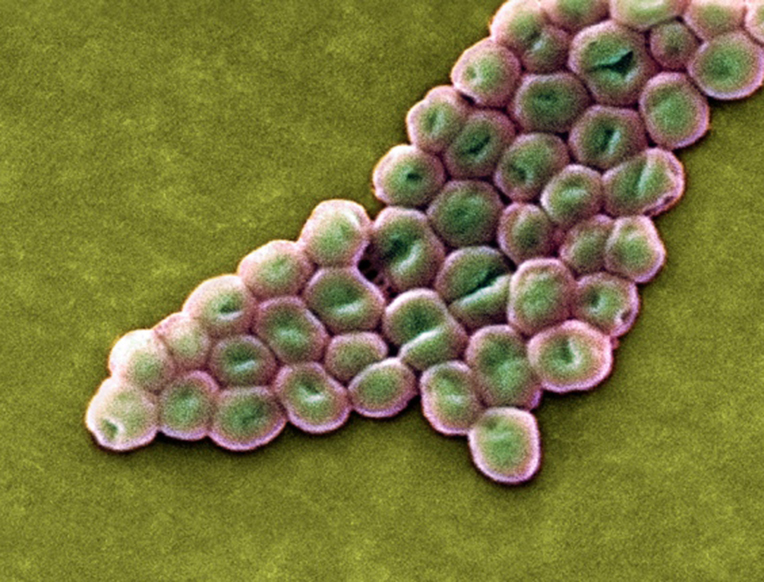 Drug-Resistant Bacteria Pose Health Threats