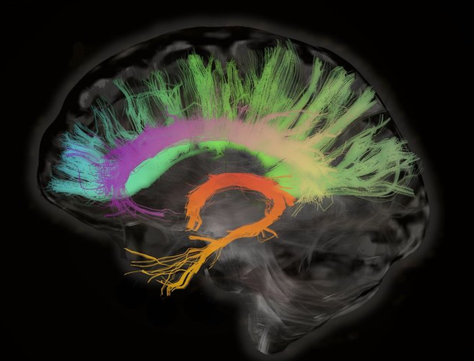 Scans Show Female Brains Remain Youthful as Male Brains Wind Down