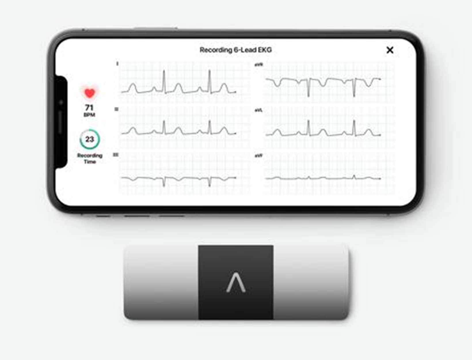 AliveCor