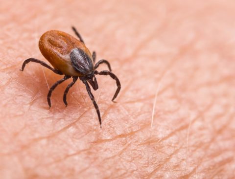Lyme Disease