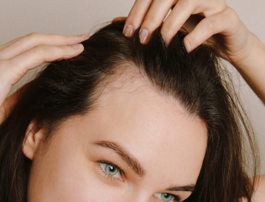 A Breakthrough in Treating Hair Loss from Alopecia Areata | goop