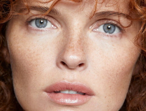 What’s New at the Dermatologist? (Everything from Lasers to a New Kind of Filler, Plus Why “Baby Botox” Isn’t What You Think It Is)