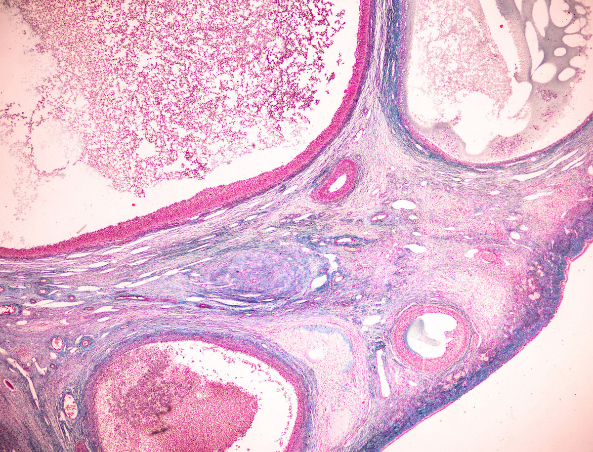 what-do-ovarian-reserve-test-results-mean-and-can-i-improve-them-goop